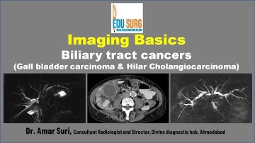 Gall bladder cancer & hilar cholangiocarcinoma radiology masterclass-Imaging basics-Edusurg clinics
