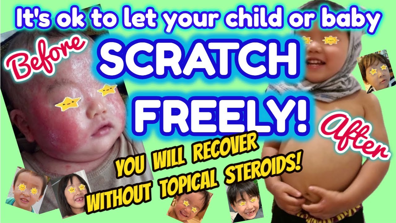 It's Ok To Let Your Child Or Baby Scratch Freely!【VIEWER DISCRETION IS