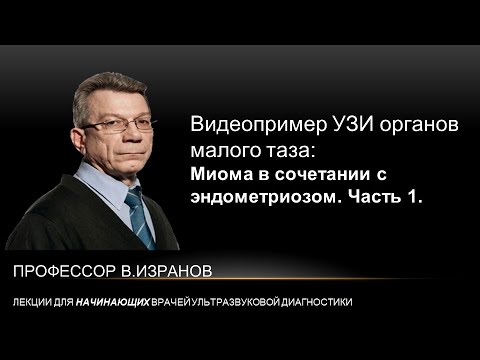 Видео пример: УЗИ малого таза. Миома в сочетании с аденомиозом. Часть 1.