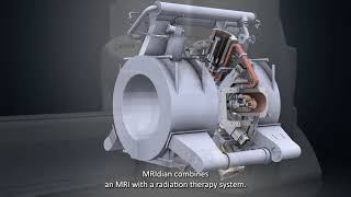 MRIdian MRI-guided Radation Therapy for Prostate Cancer