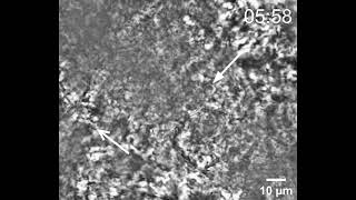 Noninvasive interception of circulating leukocyte in vivo by optical tweezer array - Supp. Video 2
Noninvasive interception of circulating leukocyte in vivo by optical tweezer array - Supplementary Video 2
https://www.worldscientific.com/doi/10.1142/S1793545825500348
Journal of Innovative Optical Health Sciences
https://www.worldscientific.com/worldscinet/jiohs Noninvasive interception of circulating leukocyte in vivo by optical tweezer array - Supp. Video 2