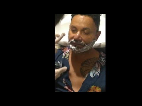First Wash After Beard Transplant | Zty Health Turkey