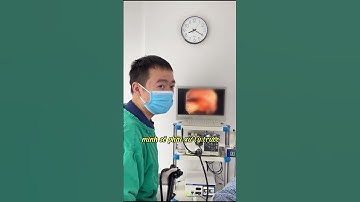 Can thiệp cắt đa polyp đại tràng cho người bệnh.