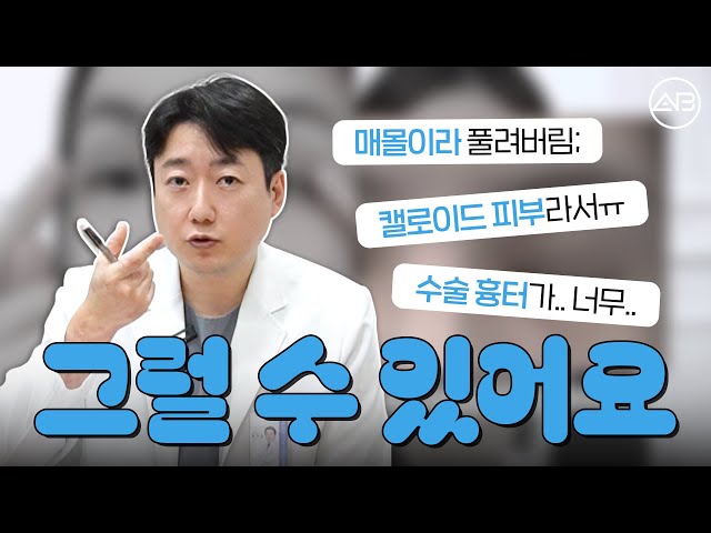 쌍꺼풀 계속 풀리는 사람도 있습니다 | 에이비성형외과