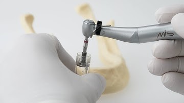 MIS LYNX Tutorial Video