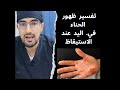 ما سبب ظهور بقع الحناء على اليد عند الاستيقاظ الدكتور قادري مصعب 