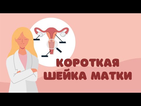 Короткая шейка матки стоит ли бояться и помогает ли пессарий? Др. Елена Березовская