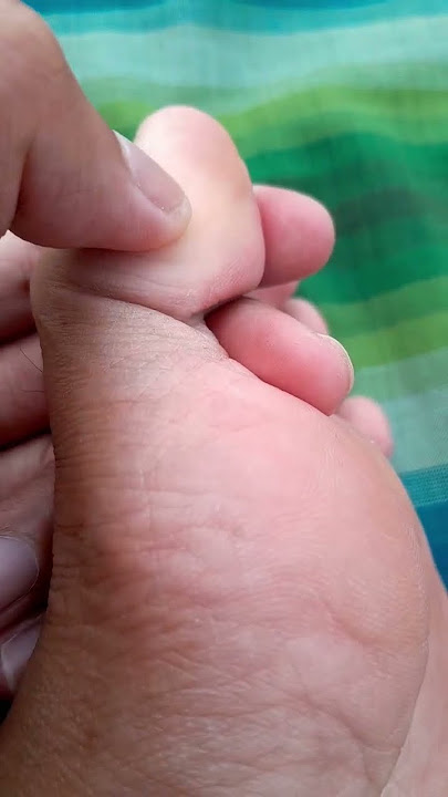 tanpa obat flu bisa sembuh hanya dengan refleksi bisa di coba oleh semua orang mudah dan simple