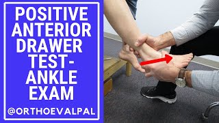 Positive Anterior Drawer Test-Ankle Exam