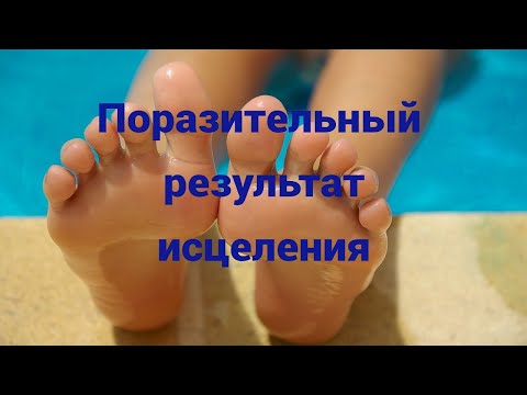🔥БАРМАТУХА лечит не
