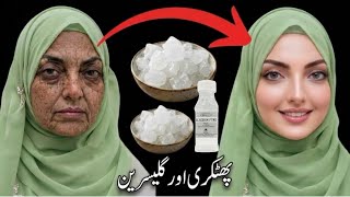 Alum & Glycerin Anti-Aging Wrinkle Removal Remedy By RabailsSecrets 💥🤩