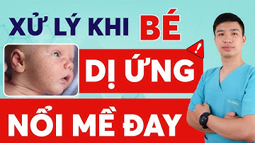 Xử lý khi bé bị dị ứng, nổi mề đay | Dr Thắng