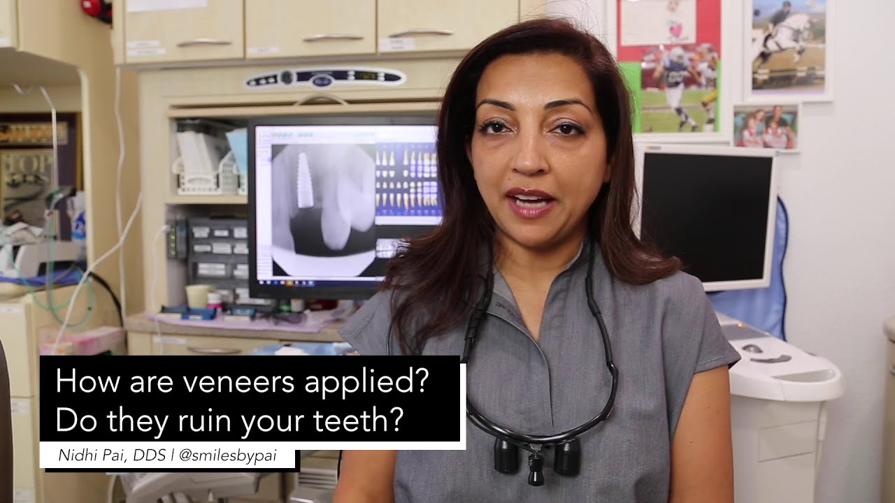Veneers FAQ with Nidhi Pai, DDS | Smiles by Pai