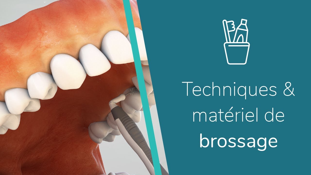 Comment utiliser les brossettes interdentaires ?