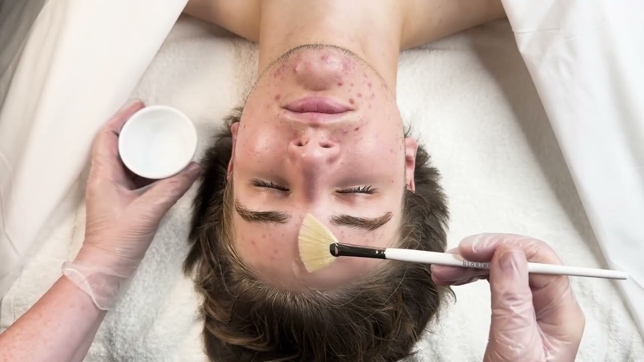 Bioelements Acne + Pore Clearing Treatment