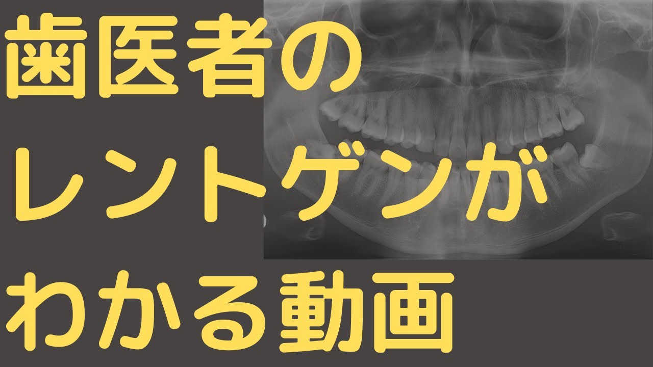 歯医者さんのレントゲンの見方【現役歯科医師が解説】