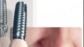 Sistema De Implantes Dentales