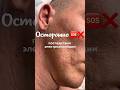 Электроэпиляция: шрамы на 10 лет! Почему лазерная эпиляция безопаснее? #лазернаяэпиляция