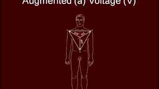 Vector Analysis - 3 leads