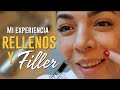 Rellenos y Fillers: Mi Experiencia