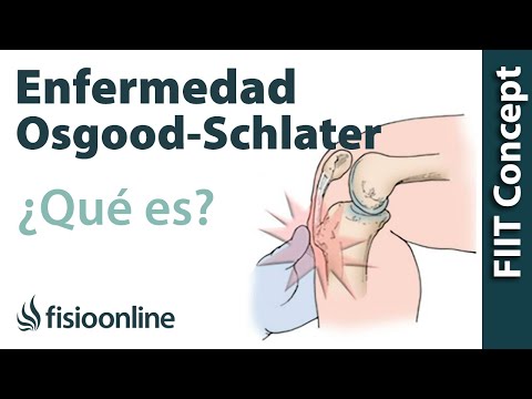 Qué son las crecederas o enfermedad OSGOOD SCHLATTER