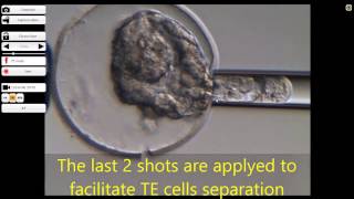 Expanded blastocyst biopsy