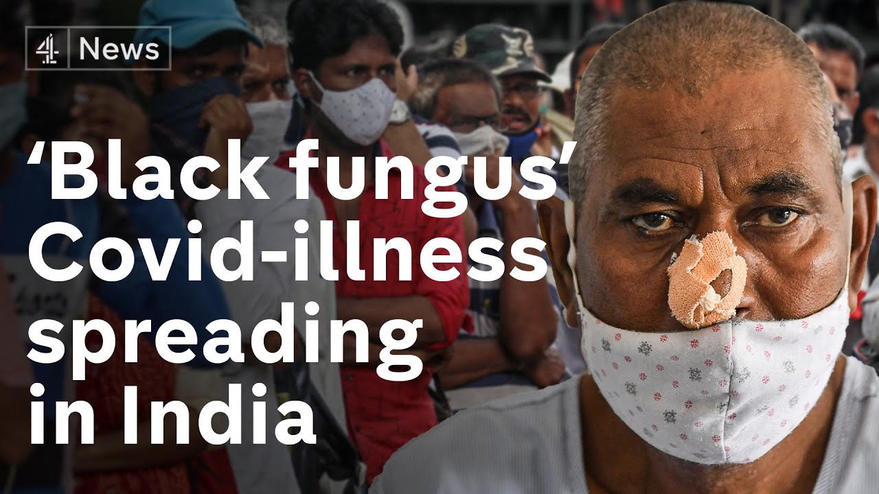 Covid Linked Black Fungus Infection Spreading In India Youtube
