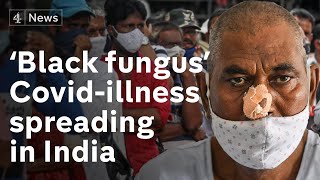 Covid-linked ‘black fungus’ infection spreading in India