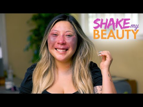 Revealing My Birthmark On A Date | SHAKE MY BEAUTY