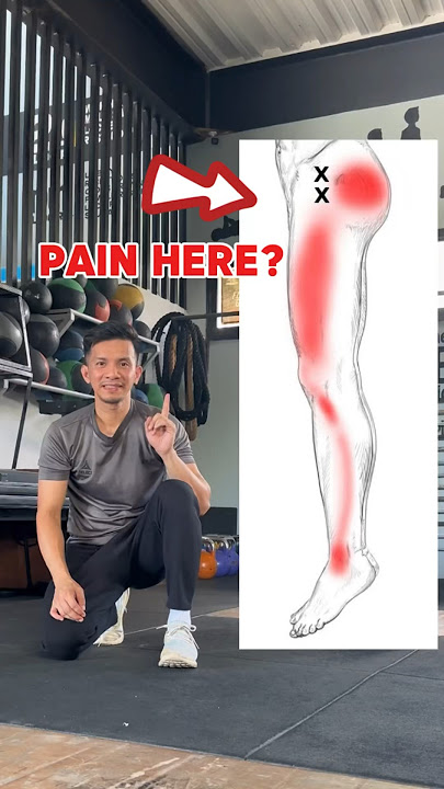 ILIOTIBIAL BAND SYNDROME PAIN RELIEF!! 🤩🤩🤩 #itbs #kneepain #hippainrelief #trending