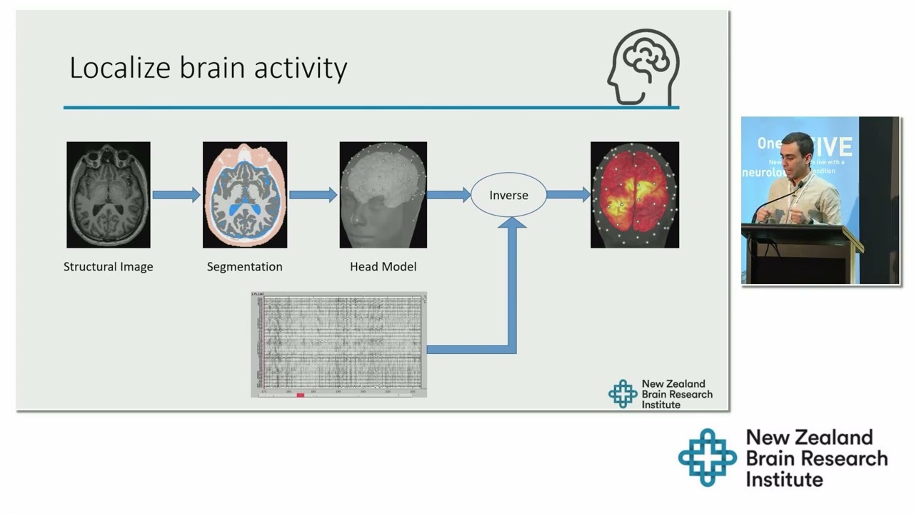 Dr Reza Shoorangiz - Functional Brain Imaging