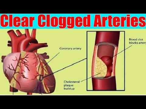 PREPARE IT BEFORE THE PHARMACISTS ERASE IT! 4 TABLESPOONS OF THIS AND YOU CAN SAY GOODBYE TO HIGH