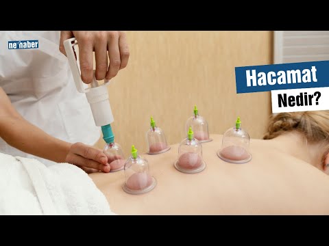 Hacamat Nedir?
