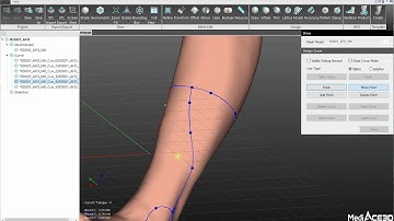 Solid AFO Design by MediACE3D