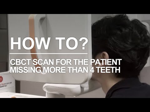 CBCT workflow thumbnail preview