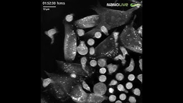 Cancer cells evade frenzied attack from T cells