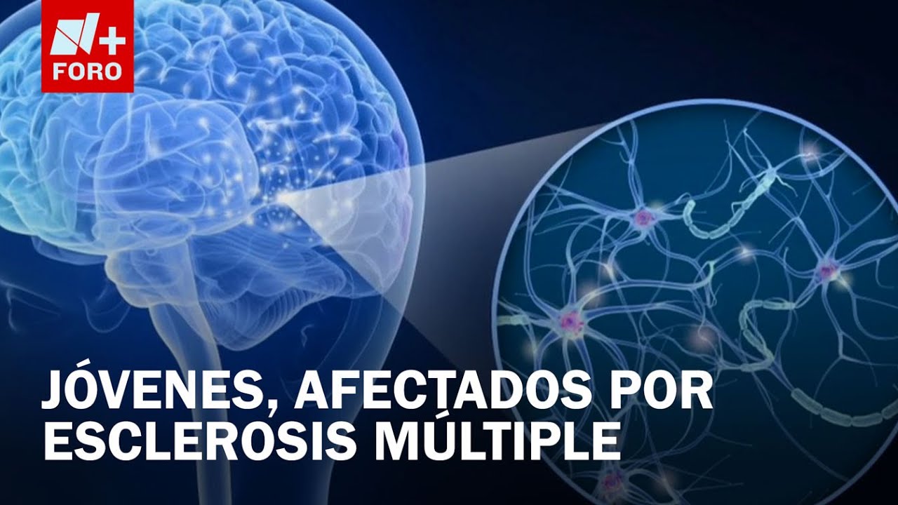 ¿Qué es la esclerosis múltiple y cuáles son los síntomas? - Sábados de N+ FORO