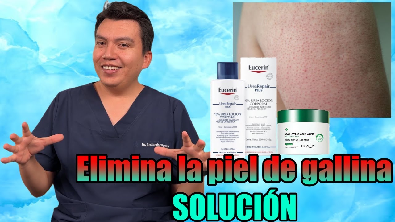 Piel de gallina en los brazos y piernas SOLUCIÓN (Queratosis pilaris) #