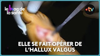 Hallux Valgus Quand Faut-Il Opérer ?