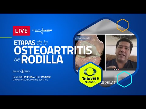 Vídeo: Etapas De La Osteoartritis De La Rodilla