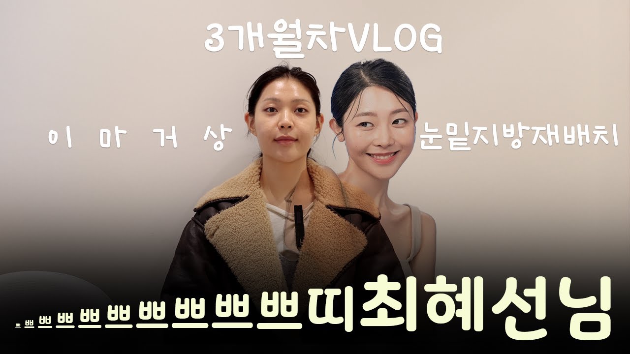 이마거상과 눈밑지방재배치 성형 3개월차 VLOG | 인터뷰