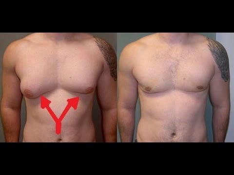 How can you get rid of chest fat?