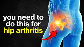 You Need to Be Doing These Exercises to Avoid Hip Replacement