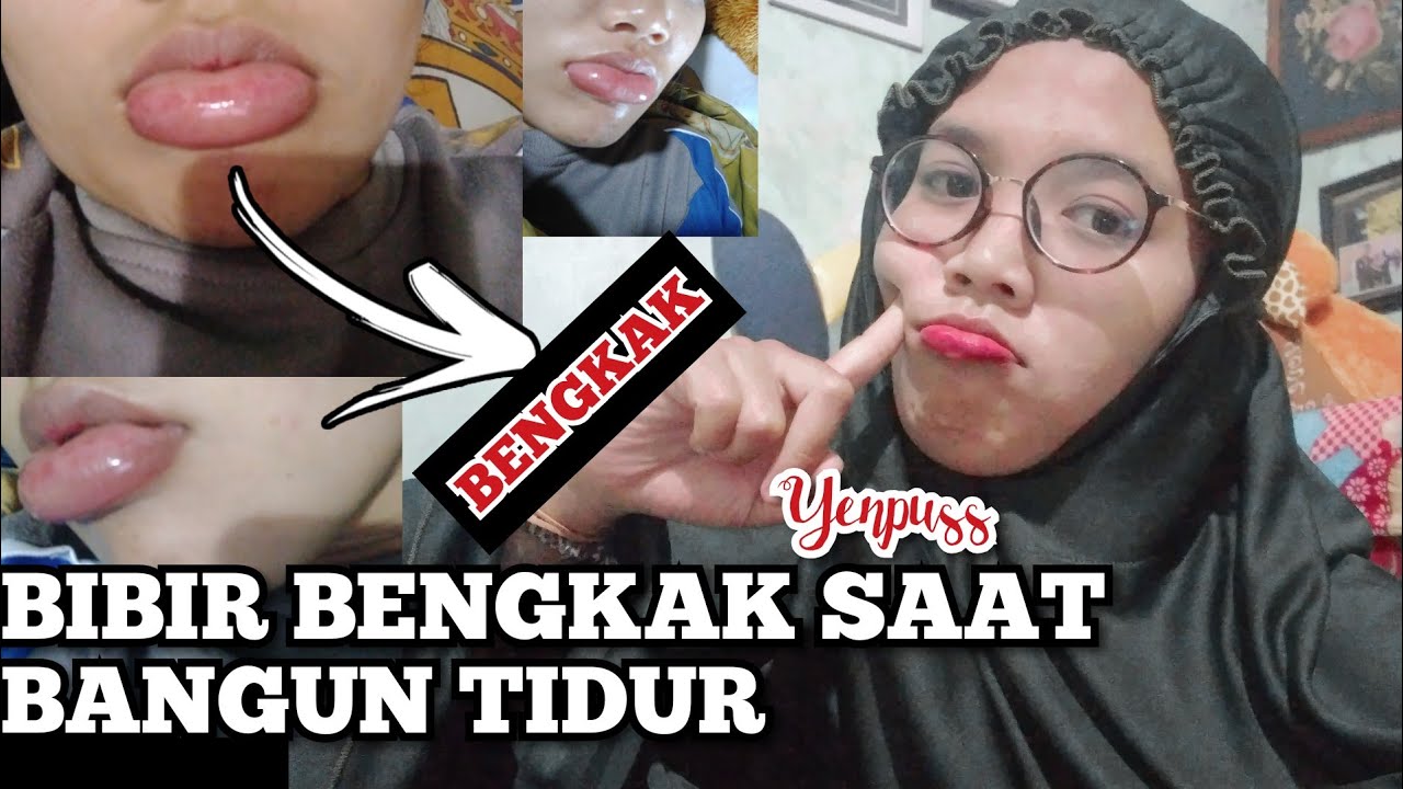 BIBIR TIBA-TIBA BENGKAK SAAT BANGUN TIDUR - YouTube