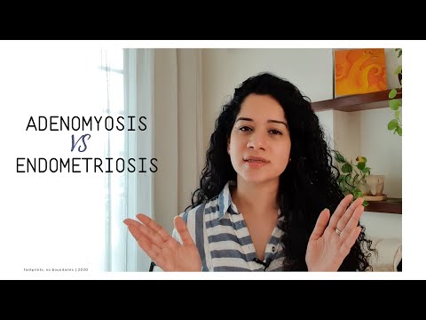 Videó: Adenomyosis Vs. Endometriosis: Tünetek, Okok és Kezelés