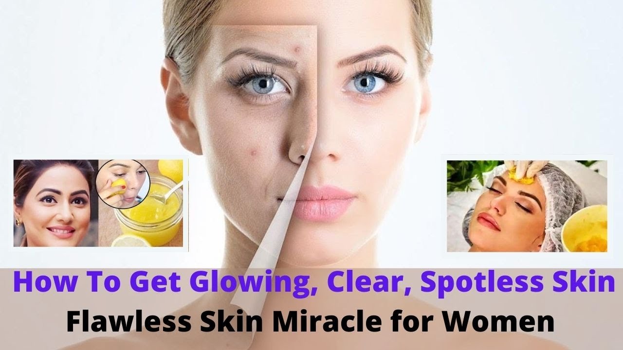 How To Get Glowing, Clear, Spotless Skin | Flawless Skin Miracle for ...