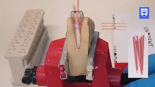 Endodontic treatment of the single rooted tooth. Part 6: Obturation