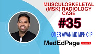 Musculoskeletal Msk Radiology Case