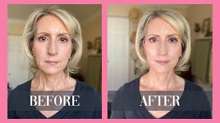 How to Get Rid of Neck Lines \& Jowls Without Surgery or Fillers