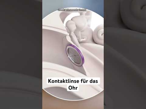 Start-Up Vibrosonic macht Hören durch eine Kontaktlinse möglich! #forschung #vibrosonic #innovation